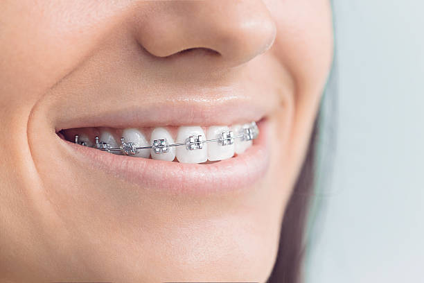 Best Traditional Braces  in Conehatta, MS